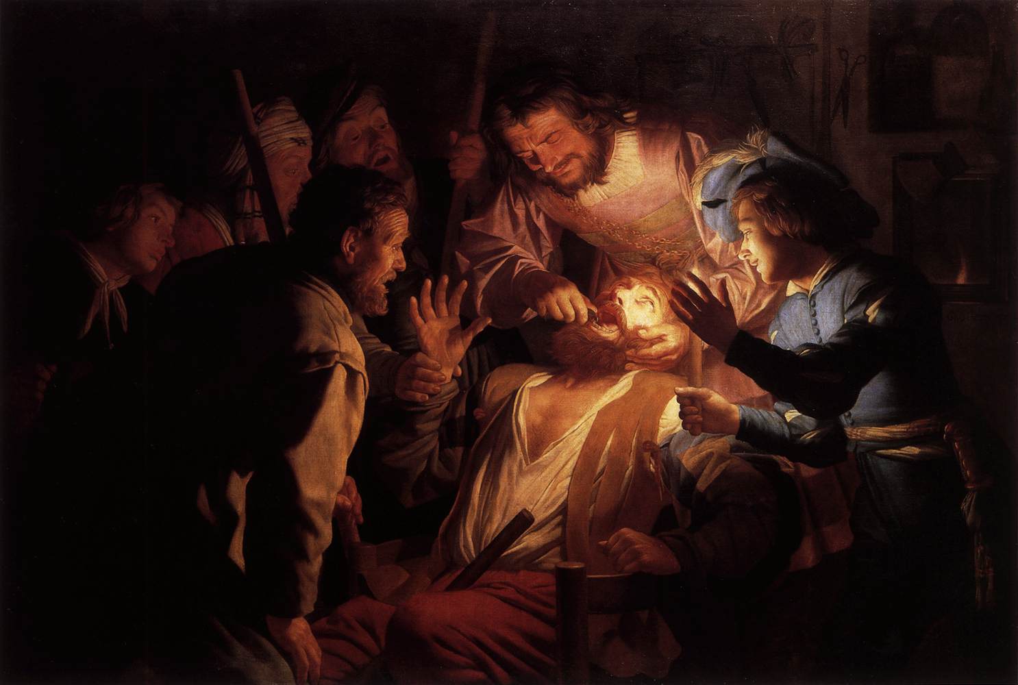 Le dentiste - Gerrit van Honthorst