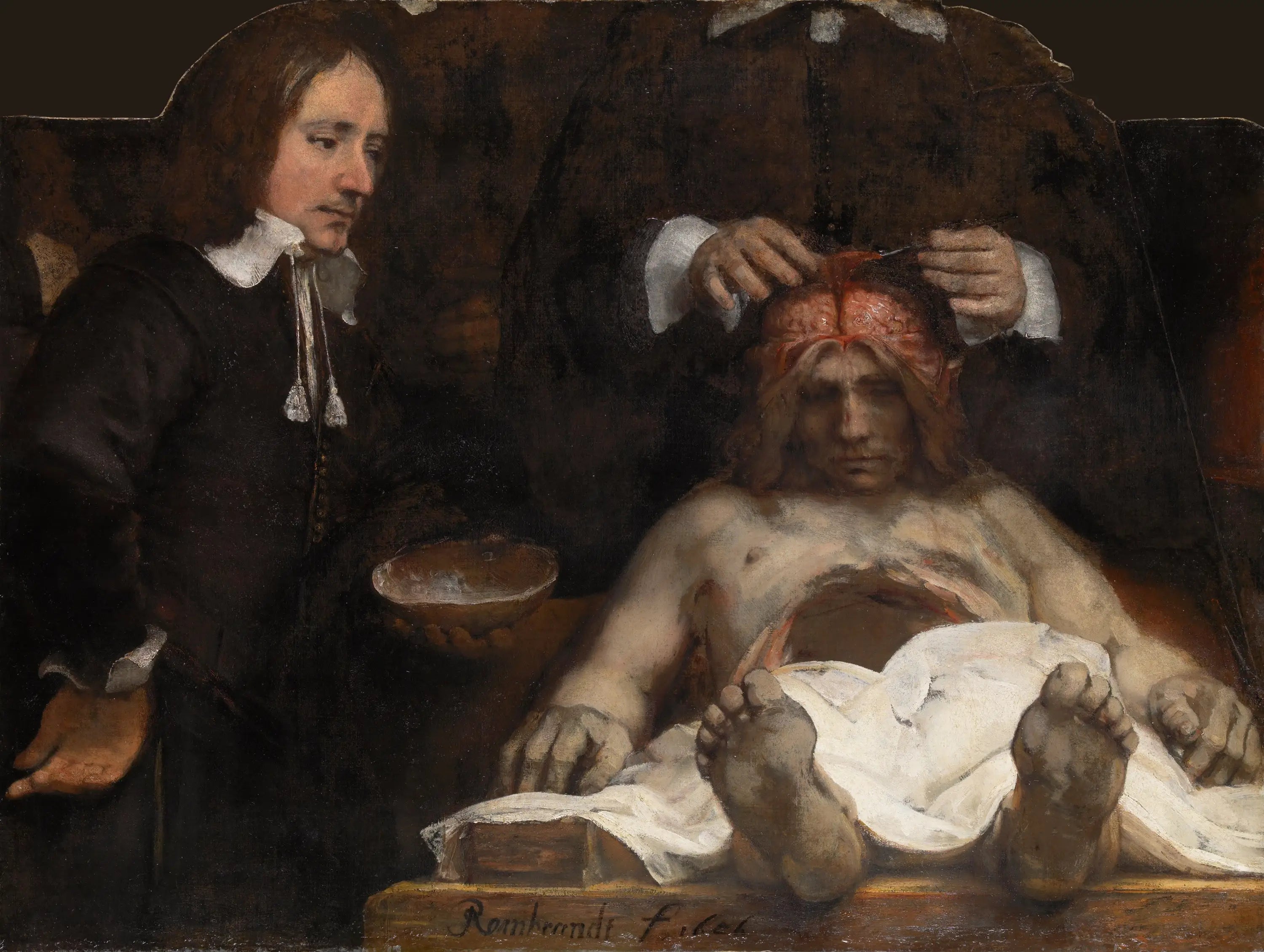 Reproduction du tableau « La Leçon d'anatomie du Docteur Joan Deyman - Rembrandt » par Alpha Reproduction en peinture à l’huile